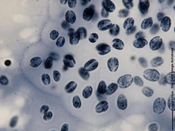 M002a 100x.JPG